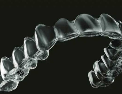 3D Printing Works Well in Dentistry